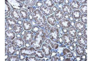 Immunohistochemistry (IHC) image for anti-Malate Dehydrogenase 2, NAD (Mitochondrial) (MDH2) antibody (ABIN2856204)