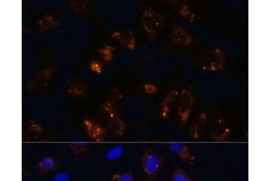 Immunofluorescence analysis of U2OS cells using TGFB1 Polyclonal Antibody at dilution of 1:100. (TGFB1 Antikörper)