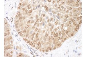 Immunohistochemistry (IHC) image for anti-BRCA1/BRCA2-Containing Complex, Subunit 3 (BRCC3) (AA 266-316) antibody (ABIN7454833)