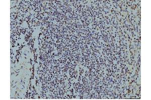 IHC analysis of LSM8 using anti-LSM8 antibody (ABIN7599578). (NAA38 Antikörper  (AA 1-96))