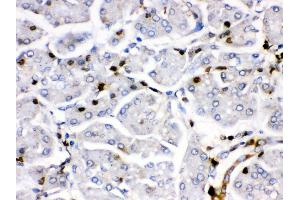 Immunohistochemistry (IHC) image for anti-FBJ Murine Osteosarcoma Viral Oncogene Homolog B (FOSB) (AA 264-291), (C-Term) antibody (ABIN3042399)