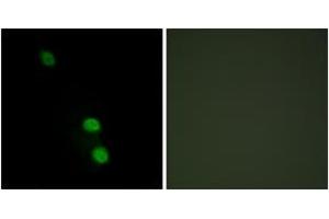 Immunofluorescence analysis of HepG2 cells, using TEAD2 Antibody. (TEAD2 Antikörper  (AA 71-120))