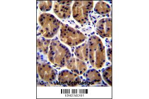 PKP2 Antibody immunohistochemistry analysis in formalin fixed and paraffin embedded human stomach tissue followed by peroxidase conjugation of the secondary antibody and DAB staining. (Plakophilin 2 Antikörper  (C-Term))