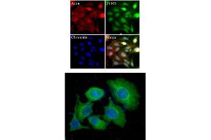 HeLa cells were stained with monoclonal anti-TYMS antibody (Green).