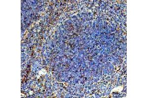 IHC analysis of 2B4/Cd244 using anti-2B4/Cd244 antibody (ABIN7600551).