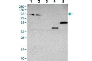 Western blot analysis of Lane 1: RT-4, Lane 2: U-251 MG, Lane 3: Human Plasma, Lane 4: Liver, Lane 5: Tonsil with ZNF235 polyclonal antibody  at 1:250-1:500 dilution. (ZNF235 Antikörper)