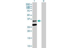 Western Blot analysis of ASPA expression in transfected 293T cell line by ASPA MaxPab polyclonal antibody. (ASPA Antikörper  (AA 1-313))