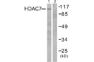 Western blot analysis of extracts from HuvEc cells, using HDAC7 antibody (#C0227). (HDAC7 Antikörper)
