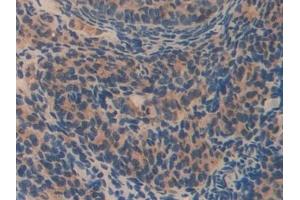Immunohistochemistry (IHC) image for anti-Olfactomedin 4 (OLFM4) (AA 238-500) antibody (ABIN7431236)