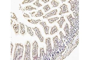 IHC analysis of H1F0 using anti-H1F0 antibody (ABIN7600521). (Histone H1 Antikörper  (AA 20-159))