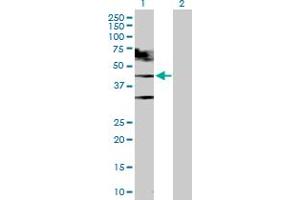 Western Blot analysis of TARDBP expression in transfected 293T cell line by TARDBP MaxPab polyclonal antibody. (TARDBP Antikörper  (AA 1-414))