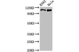 Western Blot Positive WB detected in: K562 whole cell lysate, Hela whole cell lysate All lanes: C16orf62 antibody at 3 μg/mL Secondary Goat polyclonal to rabbit IgG at 1/50000 dilution Predicted band size: 110, 94 kDa Observed band size: 110 kDa (C16orf62 Antikörper  (AA 6-205))