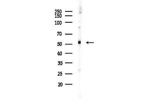 Western blot analysis of lysates from  cells(heat-shock, 45 min treatment), using CALCOCO2 Antibody at 1/1000 dilution.
