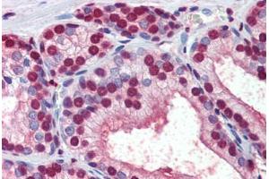 Human Prostate (formalin-fixed, paraffin-embedded) stained with  antibody ABIN462276 followed by biotinylated secondary antibody, alkaline phosphatase-streptavidin and chromogen. (CRABP1 Antikörper  (AA 1-137))