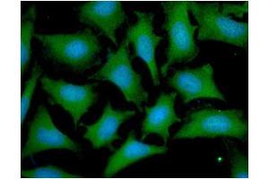 anti-OTU Domain, Ubiquitin Aldehyde Binding 1 (OTUB1) (AA 1-271) antibody