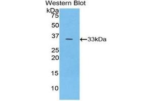 Detection of Recombinant PYGB, Human using Polyclonal Antibody to Glycogen Phosphorylase, Brain (PYGB) (PYGB Antikörper  (AA 477-731))