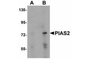 Image no. 1 for anti-Protein Inhibitor of Activated STAT, 2 (PIAS2) (N-Term) antibody (ABIN478291) (PIAS2 Antikörper  (N-Term))