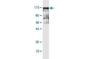 Western Blot detection against Immunogen (143 KDa) . (Vinculin Antikörper  (AA 1-1066))