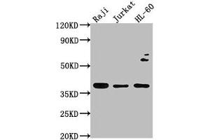 Western Blot Positive WB detected in: Raji whole cell lysate, Jurkat whole cell lysate, HL-60 whole cell lysate All lanes: RASSF2 antibody at 1:2000 Secondary Goat polyclonal to rabbit IgG at 1/50000 dilution Predicted band size: 38, 18 kDa Observed band size: 38 kDa