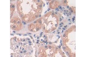 IHC-P analysis of Human Tissue, with DAB staining. (Peroxiredoxin 2 Antikörper  (AA 6-164))