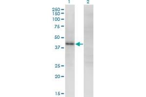 Western Blot analysis of ZSCAN16 expression in transfected 293T cell line by ZNF435 monoclonal antibody (M01), clone 4A9. (ZSCAN16 Antikörper  (AA 132-230))
