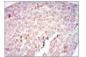Immunohistochemistry (IHC) image for anti-V-Raf-1 Murine Leukemia Viral Oncogene Homolog 1 (RAF1) antibody (ABIN1108823) (RAF1 Antikörper)