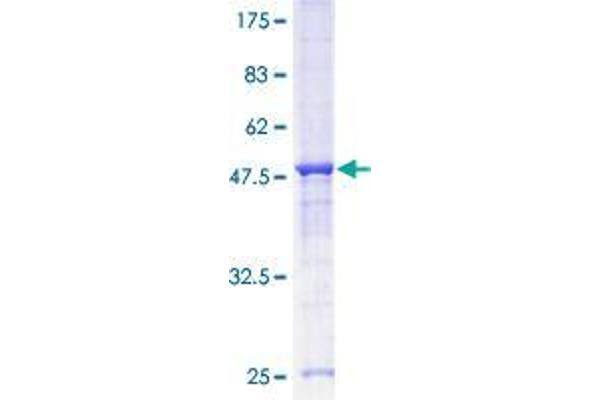 GRAP Protein (AA 1-217) (GST tag)