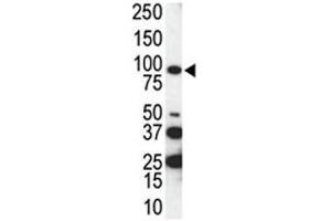 Western blot analysis of AXL antibody and SKBR3 cell lysate.