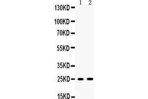 Anti- PSCA Picoband antibody, Western blotting All lanes: Anti PSCA  at 0. (PSCA Antikörper  (AA 21-95))