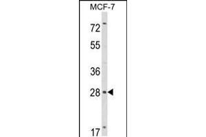 Western blot analysis of RASL11B Antibody in MCF-7 cell line lysates (35ug/lane)