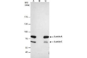 Immunoprecipitation (IP) image for anti-Lamin A/C (LMNA) antibody (ABIN2854943)