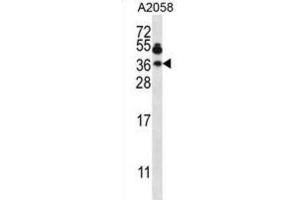 Western Blotting (WB) image for anti-Vesicle-Associated Membrane Protein 7 (VAMP7) antibody (ABIN2997586)
