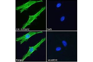 ABIN570824 Immunofluorescence analysis of paraformaldehyde fixed HeLa cells, permeabilized with 0. (SLC12A2 Antikörper  (Internal Region))