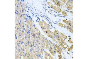 Immunohistochemistry of paraffin-embedded mouse stomach using CASP9 antibody at dilution of 1:100 (x40 lens).