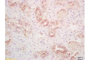 Formalin-fixed and paraffin embedded rat thyroid labeled with Rabbit Anti PLRP1/PNLIPRP1 Polyclonal Antibody, Unconjugated (ABIN718826) at 1:200 followed by conjugation to the secondary antibody and DAB staining (PNLIPRP1 Antikörper  (AA 375-467))