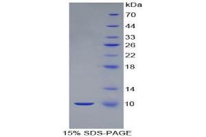 SDS-PAGE (SDS) image for S100 Calcium Binding Protein B (S100B) (AA 1-92) protein (His tag) (ABIN1080767)