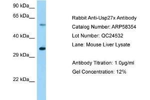 Western Blotting (WB) image for anti-Ubiquitin Specific Peptidase 27, X-Linked (USP27X) (Middle Region) antibody (ABIN2787648) (USP27X Antikörper  (Middle Region))