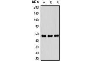 Western blot analysis of PDE1B expression in THP1 (A), mouse brain (B), mouse spleen (C) whole cell lysates.