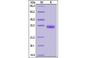 SARS-CoV-2 S protein RBD (R408I), His Tag on SDS-PAGE under reducing (R) condition.