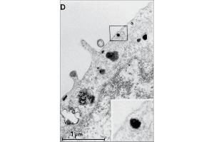 Electron microscopic image of internalized EGF-R/antibody-complexes in A431 cells. (EGFR Antikörper  (Extracellular, non Ligand Binding Domain))