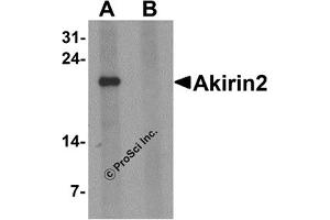 Western Blotting (WB) image for anti-Akirin 2 (AKIRIN2) (Middle Region 1) antibody (ABIN1031185)