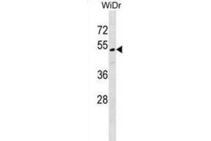 Western Blotting (WB) image for anti-MLF1 Interacting Protein (MLF1IP) antibody (ABIN2999451) (MLF1IP Antikörper)