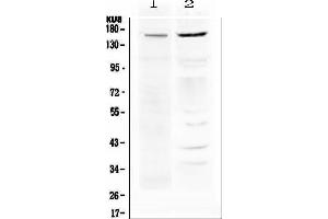 Western Blotting (WB) image for anti-ATP-Binding Cassette, Sub-Family B (MDR/TAP), Member 1 (ABCB1) antibody (ABIN5693064) (ABCB1 Antikörper)