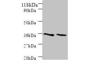 Western blot All lanes: SNX20 antibody at 2 μg/mL Lane 1: Mouse spleen tissue Lane 2: Mouse skeletal muscle tissue Secondary Goat polyclonal to rabbit IgG at 1/10000 dilution Predicted band size: 37, 18, 15, 12 kDa Observed band size: 37 kDa (Sorting Nexin 2 Antikörper  (AA 1-102))
