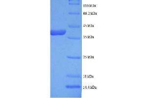 SDS-PAGE (SDS) image for Lactate Dehydrogenase B (LDHB) (AA 2-334), (full length) protein (His tag) (ABIN1047316)
