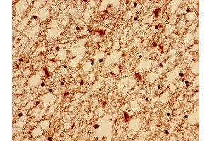 Immunohistochemistry (IHC) image for anti-ELAV (Embryonic Lethal, Abnormal Vision, Drosophila)-Like 2 (Hu Antigen B) (ELAVL2) (AA 4-356) antibody (ABIN7151479)