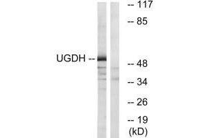 Western blot analysis of extracts from COLO cells, using UGDH antibody.