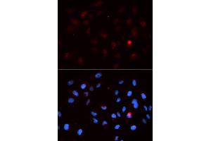 Immunofluorescence analysis of MCF7 cell using Phospho-CDK1-T14 antibody. (CDK1 Antikörper  (pThr14))