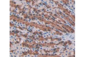 Used in DAB staining on fromalin fixed paraffin- embedded stomach tissue (PTPN22 Antikörper  (AA 1-256))