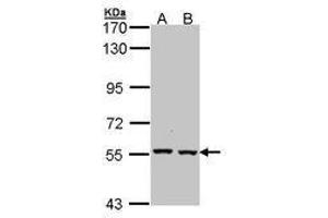 Image no. 1 for anti-Catalase (CAT) (AA 89-311) antibody (ABIN467582) (Catalase Antikörper  (AA 89-311))